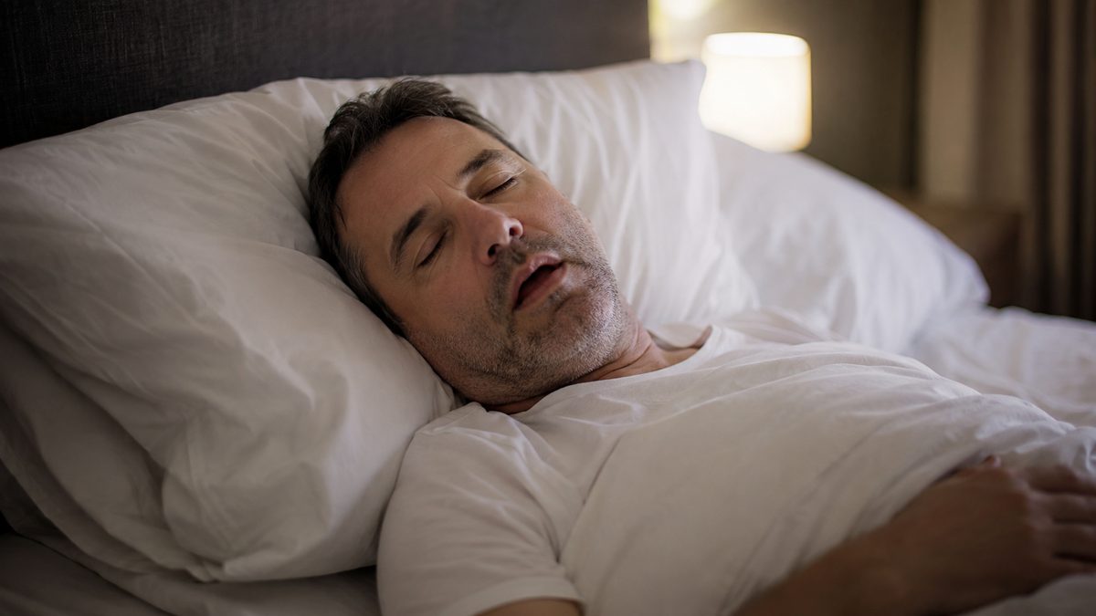 What is the #1 cause of sleep apnea?